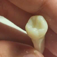 رویداد یادگیری اناتومی دندان