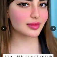 ژل،بوتاکس،فیلربادی باسن بیکینی،پی ارپی زاویه سازی|خدمات زیبایی و سلامت|تبریز, |دیوار