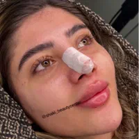 مدل بوتاکس و پی ار پی و کانتورینگ صورت با فیلر|خدمات آرایشگری و زیبایی|اصفهان, ملک‌شهر|دیوار