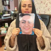جراحی پلاستیک بینی دکتربادامچی