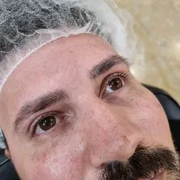 میکروبلیدینگ و میکروپیگمنتیشن وریموو و هیدرالیپس|خدمات آرایشگری و زیبایی|تهران, شهرک پرواز|دیوار