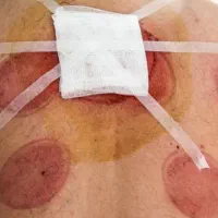 ژل وبوتاکس ومزونیدلینگ وحجامت|خدمات آرایشگری و زیبایی|فولادشهر, B2|دیوار