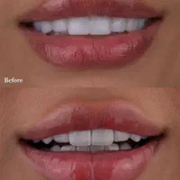 خدمات کامل دندانپزشکی|آرایشی، بهداشتی، درمانی|شیراز, فرهنگ شهر|دیوار