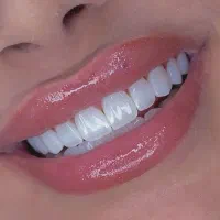 تخفیف ویژه کامپوزیت