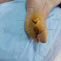 درمان تضمینی بیماری های لاعلاج و صعب العلاج|خدمات آرایشگری و زیبایی|فردیس, فردیس|دیوار