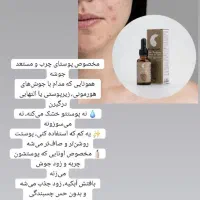 درمان سریع با محصولات گیاهی اریا دانش بنیان|آرایشی، بهداشتی، درمانی|بندرعباس, |دیوار