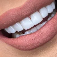 دندانسازی سیاربهترین وارزانترین خدمات