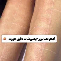 لیزر کندلا با قیمت دوسال پیش|خدمات آرایشگری و زیبایی|اصفهان, بهار آزادی|دیوار