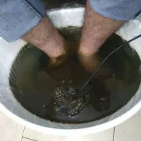 لیزر ژل وبوتاکس وخالبرداری سم زدایی|خدمات آرایشگری و زیبایی|تبریز, |دیوار