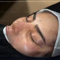 جشنواره عمل بینی ، لیفت شقیقه، اندسکوپیک، مید فیس|خدمات زیبایی و سلامت|شیراز, ستارخان|دیوار