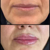 خدمات زیبایی در کلینیک تخصصی|خدمات زیبایی و سلامت|تبریز, |دیوار