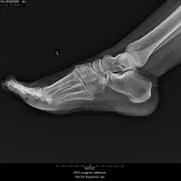 فروش دستگاه رادیولوژی پرتابل همراه با کاست DR|پزشکی|اهواز, کیان اباد|دیوار
