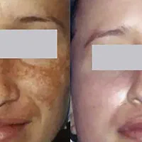 انواع روغن گیاهی اصل ضمانتی برا زیبایی پوست ورشدمو|آرایشی، بهداشتی، درمانی|سراوان, |دیوار