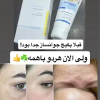 ضد لک و ضد چروک|آرایشی، بهداشتی، درمانی|اصفهان, باغ زرشک|دیوار