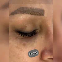 پاکسازی و فیشیال پوست  ازبین بردن لک مخصوص بانوان|خدمات آرایشگری و زیبایی|آمل, |دیوار