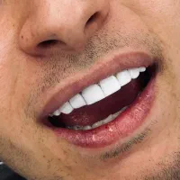 تخفیف ویژه کامپوزیت به مدت یک هفته|خدمات آرایشگری و زیبایی|اهواز, زیباشهر|دیوار
