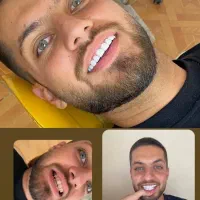 ارائه خدمات زیبایی و درمانی دندانپزشکی|خدمات آرایشگری و زیبایی|کرمانشاه, |دیوار