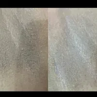 روشن سازی نواحی تیره بدن
