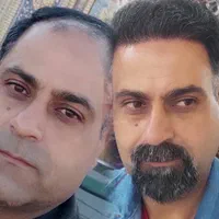 کاشت مو تضمینی در یک جلسه با تکنیک شیرازی|خدمات آرایشگری و زیبایی|یزد, |دیوار