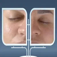 پاکسازی، فشیال