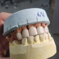 استخدام کارشناس پروتز دندان