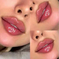 تخفیف بوتاکس ۹۹۸تومان