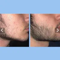 پرپشتیش علت جذاب شدنته