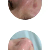 فیشال vip احیا،ابرسانی،روشن کننده