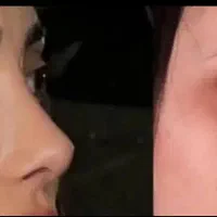 آفربهاری لیپو۴۵ابدو۶۵مامو۵۵بینی۲۹