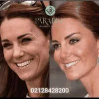 کلینیک ژل وبوتاکس تخفیفات ویژه پزشک متخصص اقساط