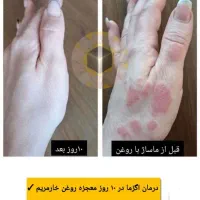 تشخیص بیماریها از روی زبان و درمان|خدمات آرایشگری و زیبایی|جیرفت, |دیوار