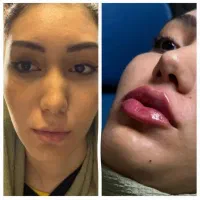 کلینیک تخصصی زیبایی لاغری کاشت ابرو مو بلفارو