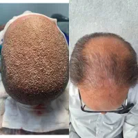 kasht|خدمات آرایشگری و زیبایی|همدان, |دیوار