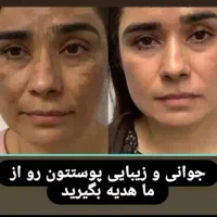کرم معجزه چهل گیاه اصلی با ضمانت|آرایشی، بهداشتی، درمانی|شیراز, کوشک میدان|دیوار