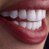 کامپوزیت سوییسی دندان با طرح طلایی شو