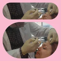 مطب زیبایی|خدمات آرایشگری و زیبایی|تهران, سهروردی|دیوار