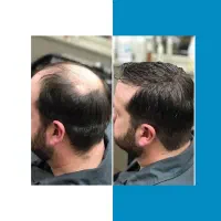 قبل از هزینه های اضافی این روش رو ببین