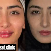 جشنواره پاییزه و افتتاح کلینیک بوتاکس وفیلر|خدمات آرایشگری و زیبایی|ارومیه, |دیوار