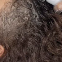 تخفیف ویژه پی آر پی با کیت آمریکایی