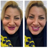 دندانسازی/دندان مصنوعی/بامجوزرسمی و۷۰سال سابقه