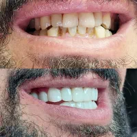 کامپوزیت زیبایی|خدمات آرایشگری و زیبایی|اسلامشهر, شهرک قائمیه|دیوار