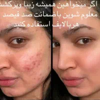 پوستت رو مثل پوست بچه کن