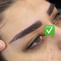 زیبایی نیلگون تخفیف میکروبلیدینگ،فیبروز،فیلر