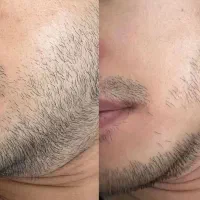ریش بیشتر،اعتماد بنفس بیشتر