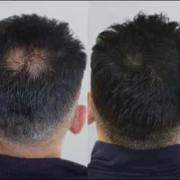 با کمترین هزینه بهترین نتیجه رو بدست بیار