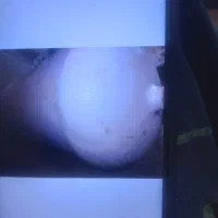 کپسول سی ان جی با لاستیک باربند