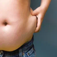 ساکشن شکم پهلو ۱۰ میلیون تومان ، پزشک ۲۰ سال تجربه