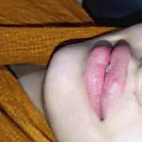 جشنواره تزریق ژل بدون درد و کبودی تضمینی|خدمات آرایشگری و زیبایی|جیرفت, |دیوار