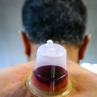 حجامت در منزل