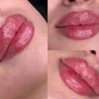 تخفیف ویژه ژل لب، بوتاکس، خط خنده ،گونه زاویه سازی|خدمات آرایشگری و زیبایی|پرند, فاز ۵|دیوار